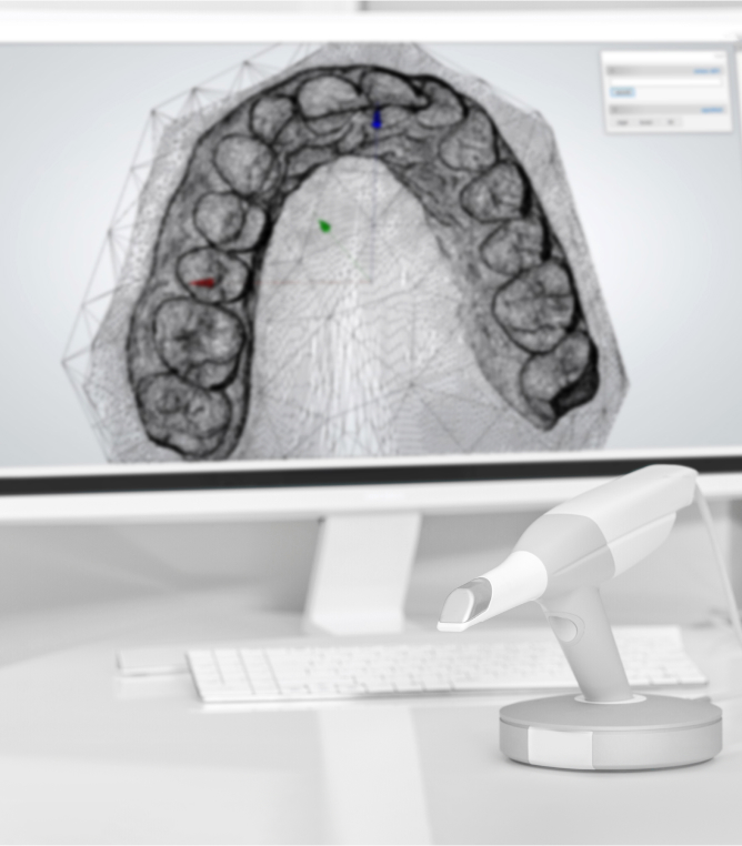 Digital teeth impressions