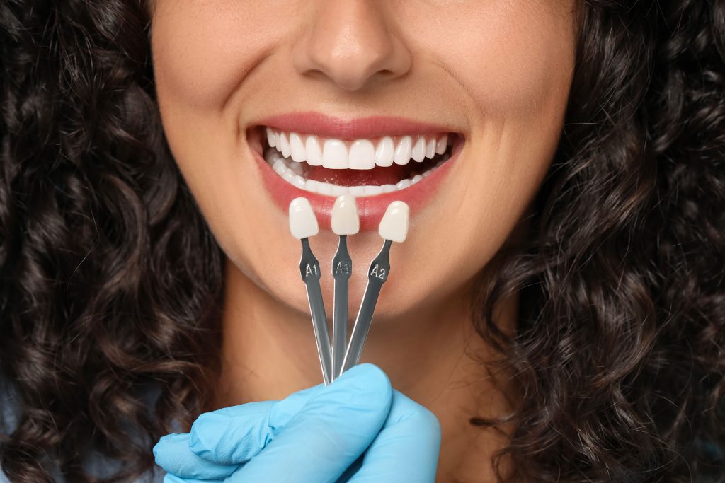 Cosmetic dentist holding up custom porcelain veneers