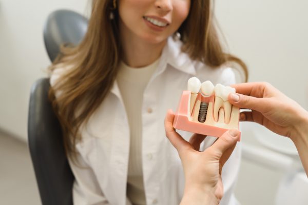 dentist showing a dental implant model